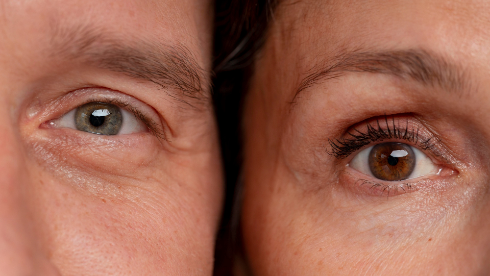 2149123575 - Accuvision Dry Eye
